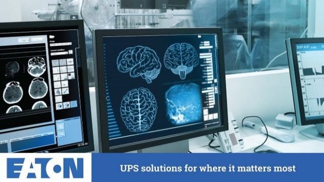 ups centralised decentralised